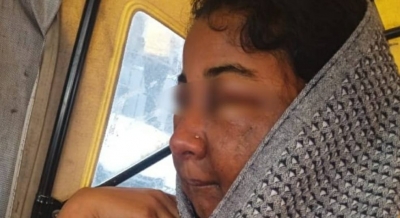 Bride-to-be in ICU after makeup, beautician detained for questioning