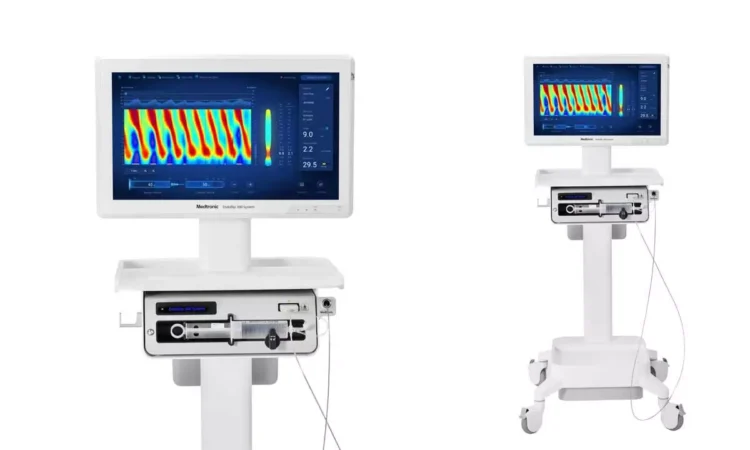 Medtronic Introduces Endoflip 300 System for Esophageal Disorders in India