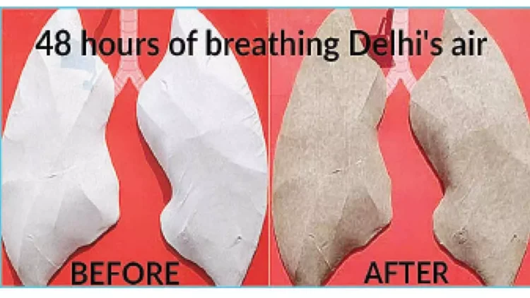 Delhi's Air Quality Crisis: BJP Faces Criticism for Inaction
